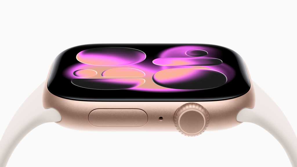 Un Apple Watch rosa