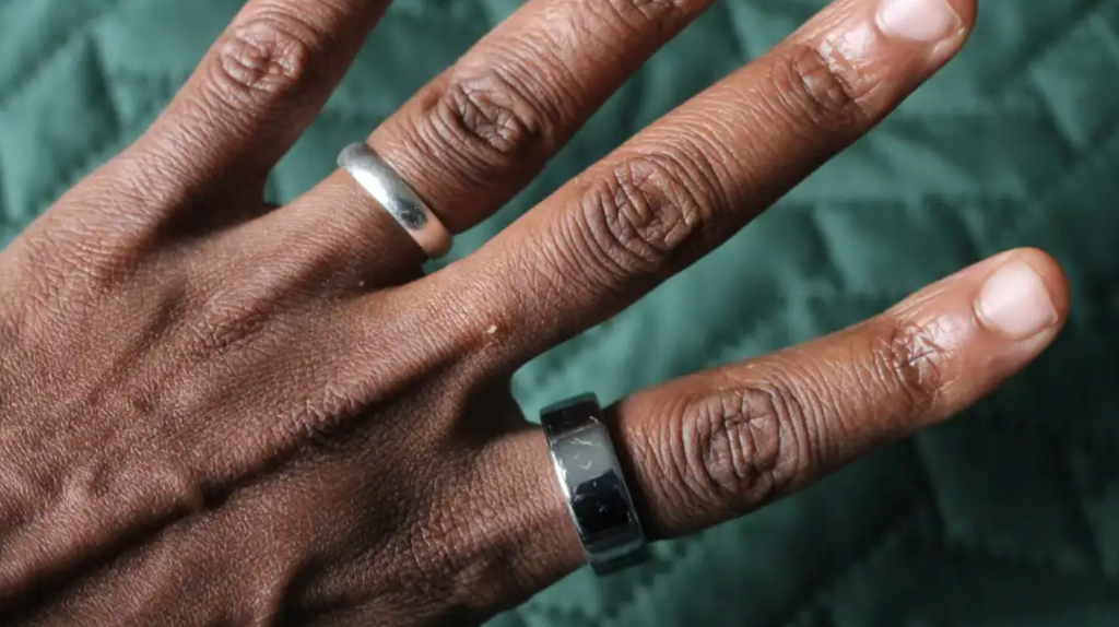 Smart-Ring